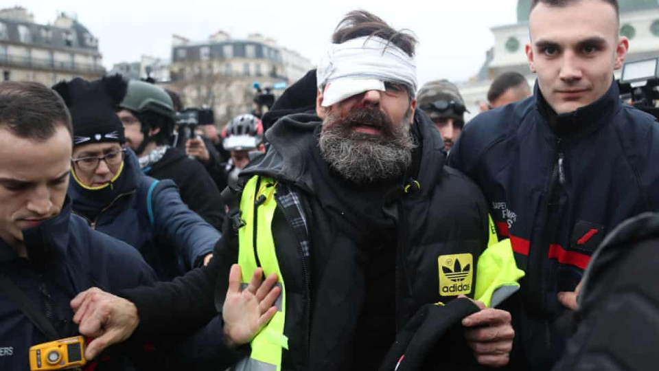 French police weapons under scrutiny after gilets jaunes injuries