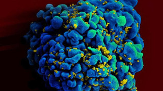 End to Aids in sight as huge study finds drugs stop HIV transmission